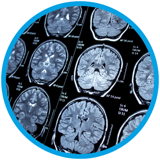 Neurology