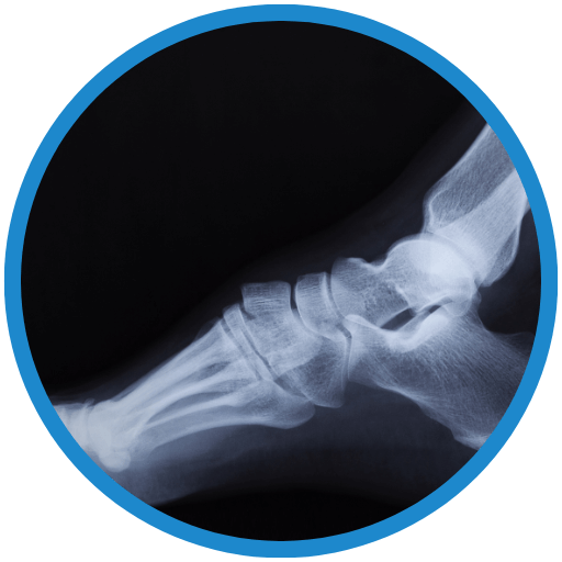 Orthopedics